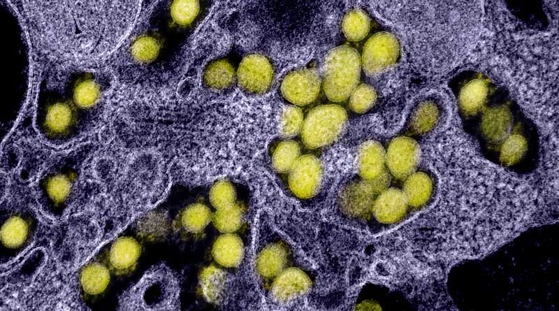 Disease detectives track an invisible virus pandemic